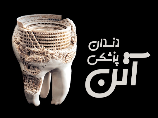 دندان پزشکی آتن